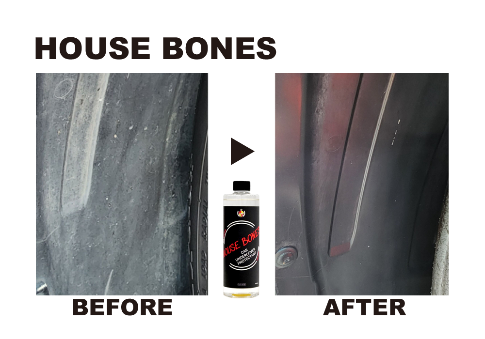 HOUSE BONES